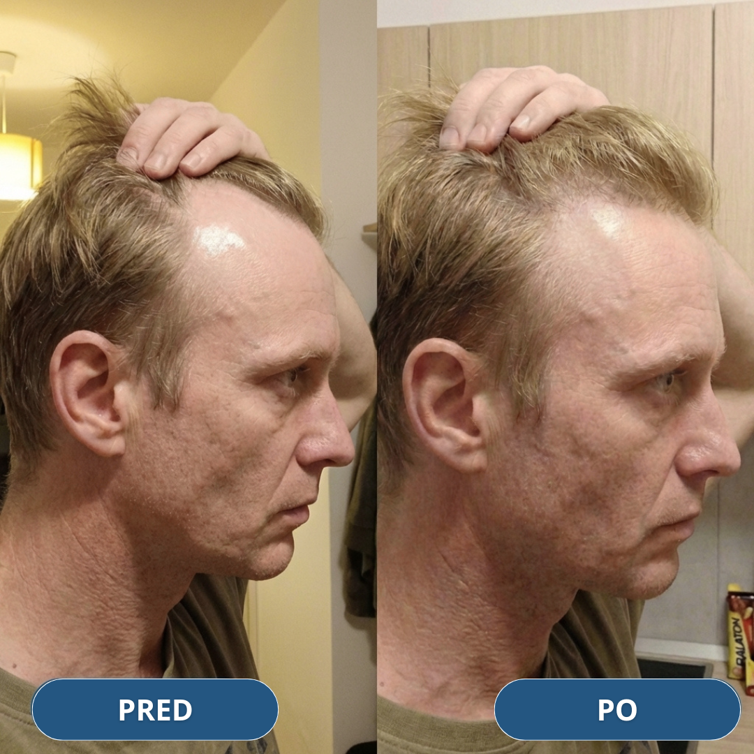 USA Hair Elixir pre mužov – extrémne účinne naštartuje rast vlasov a zastaví ich vypadávanie