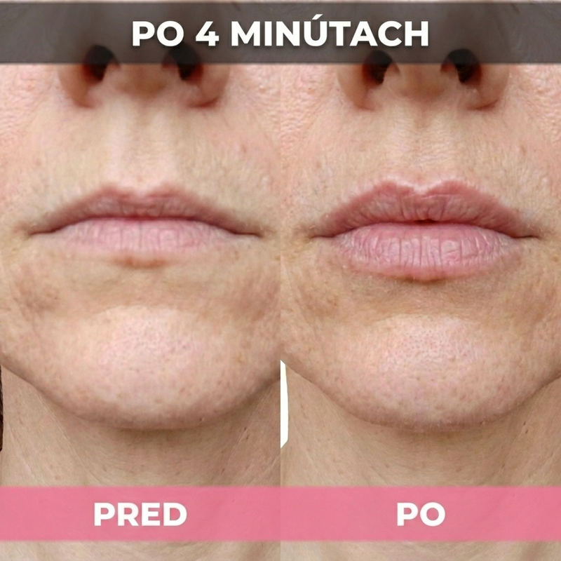 Slider Image 6