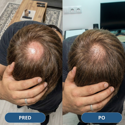 USA Hair Elixir pre mužov – extrémne účinne naštartuje rast vlasov a zastaví ich vypadávanie