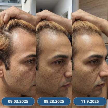 USA Hair Elixir pre mužov – extrémne účinne naštartuje rast vlasov a zastaví ich vypadávanie