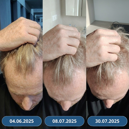 USA Hair Elixir pre mužov – extrémne účinne naštartuje rast vlasov a zastaví ich vypadávanie